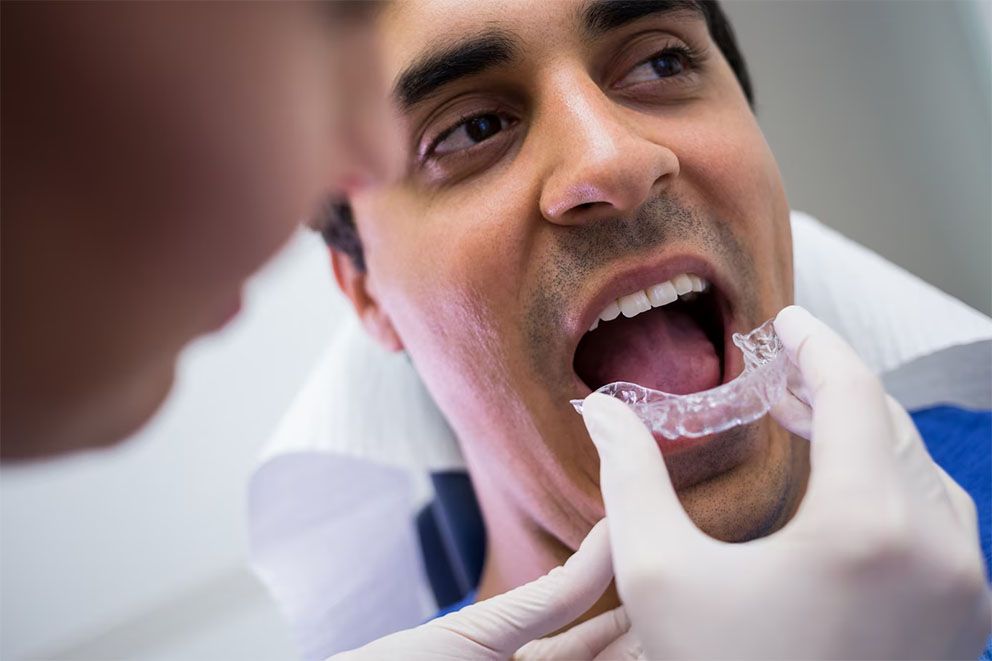 Invisalign láthatatlan fogszabályozás
